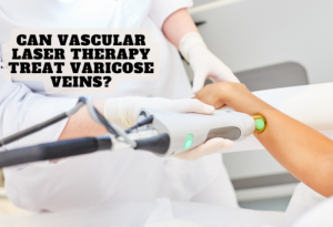 Can Vascular Laser Therapy Treat Varicose Veins?